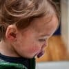 Most kids recover from measles. But the virus can be deadly and can erase the immune system's memory.